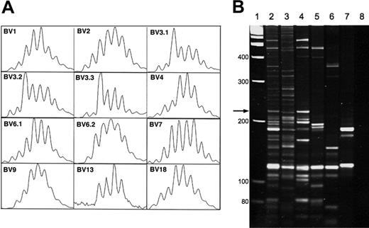 Figure 6. Polyclonal T-cell reconstitution following intravenous gene therapy. (A) T-cell diversity in dog 1547 6 months following gene therapy as determined by TCR Vβ CDR3 spectratyping for 12 distinct TCR Vβ segments. (B) Assessment of vector integration sites by LAM-PCR from genomic DNA from CD3+ cells from dog 1547 (lanes 2-4) and dog 1551 (lanes 5-7) 5 months following gene therapy. Lane 1, DNA molecular weight (MW) marker; lane 8, H2O control. → indicates size of final vector control band with incomplete digestion by PvuII.
