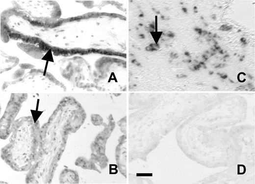Figure 5. In situ hybridizations on first trimester human placenta. In situ hybridizations on first trimester human placenta showing EPCR (A), CD39 (B), and PN1 (C) expression on trophoblast cells. Panel D shows negative stain with sense control. Bar represents 0.05 mm. EPCR and CD39 are expressed on cytotrophoblast-synctiotrophoblast bilayers of placental villi. PN1 is expressed at a different site on columns of cytotrophoblast cells.