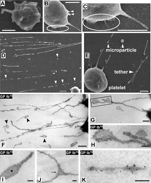 Figure 3. Scanning EM and whole-mount immuno-EM analysis of tethers and microparticles. (A-E) Citrated whole blood (platelet count, 250 000 platelets/μL) perfused over dVWFA1 at γw of 30 000 s–1. (A) Scanning electron micrograph of a perfusion-fixed activated platelet, shown for comparison. The activated platelet shows multiple filopodia protruding from the surface in all directions. (B) A nonactivated platelet adhering to VWF through GPIbα. The membrane surface is smooth, and the long passively pulled tether has less than half the diameter of filopodia. Two short protruding membrane areas (arrowheads) are indicative of nascent tethers. (C) Enlargement of a detail highlighted in panel B, showing thin and short tethers connecting the platelet body to the adhesive substrate. (D-E) Isolated microparticles and detached tethers. Scale bars = 1 μm (A-D) or 0.5 μm (E). See Movie S7. (F-K) Citrated whole blood was perfused at γw of 30 000s–1 over dVWFA1-coated EM grids, fixed under flow, and immunolabeled with monoclonal anti-GPIbα antibody followed by protein A coupled to 10-nm gold particles (GPIb10). (F-G) Severed tethers exhibiting tubular and globular domains, the latter (highlighted) corresponding to DAPs. (H-I) GPIbα in the globular tether end (DAP) is predominantly peripheral and excluded from the central zone. (J) Bifurcating tether showing peripheral GPIbα distribution in the DAP-like bifurcation zone (arrow). (K) Severed tubular tether exhibiting subdomains with variable GPIbα content. Scale bar in panel A = 1 μm; bar in panel B = 500 nm; bars in panels C to F = 200 nm.