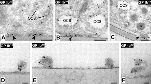 Figure 4. Immuno-EM analysis of cross-sectioned DAPs and tethers. Perfusions were carried out over melamine-plated coverslips coated with dVWFA1. Immunolabeling as described in the legend to Figure 3. The electron micrographs show DAPs of various sizes (A-C), and cross-sectioned tethers (D-F) attached to the dVWFA1 substrate. (A-B) DAPs appear in cross-section as darker areas of the membrane closely juxtaposed to the adhesive substrate and with high density of GPIbα (arrowheads); the latter is also detected in the open canalicular system (OCS). (C) A DAP (arrowhead) is in close contact with the adhesive substrate while the surrounding platelet membrane is lifting away, suggestive of a nascent tether or PMP. (D-F) Visualization of GPIbα in cross-sectioned tethers. Scale bar in panels A to C = 200 nm; bars in panels D to F = 50 nm.