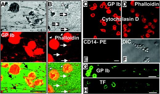 Figure 5. Immunofluorescence confocal microscopic analysis of GPIbα, F-actin, and tissue factor in perfusion-fixed tethers and microparticles. Whole blood was perfused over immobilized dVWFA1 at γw of 30 000 and 40 000 s–1. (A-B) Two fields of view were visualized by RICM (top), confocal immunofluorescence microscopy after staining with an anti-GPIbα antibody (A) or phalloidin (B) to visualize F-actin (middle), and their composite (bottom). White arrows indicate microparticles and tethers; arrowheads show platelets. Phycoerythrin (PE) immunofluorescence staining for GPIbα (A) reveals abundant receptor exposure with a few unlabeled tether segments and microparticles (black arrows). This finding indicates a heterogeneous receptor distribution suggestive of clustering and corresponds well with the immuno-EM data in Figures 3 and 4. PE immunofluorescence staining for F-actin with phalloidin, despite the relatively low intensity (B), shows a complete congruence with the RICM image in the tether ends and microparticles. (C-D) Cytochalasin D–treated platelets clearly exhibit GPIbα labeling (Cy3), as do tethers and microparticles originating from them (C), whereas the phalloidin staining for F-actin (rhodamin) can be seen in platelets but is absent in tethers and microparticles (D). (E) The specific monocyte marker CD14 could not be detected on microparticles, tethers, and platelets, which exhibit only low background fluorescence. (F) Differential interference contrast (DIC) image of the field of view shown in panels E, G, and H. Comparative fluorescence staining (fluorescein) for GPIbα and tissue factor (TF) on microparticles, tethers, and platelets. Note the more intense staining with the anti-GPIbα antibody (G) as compared with the anti-TF antibody (H). All scale bars shown = 5 μm.