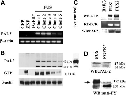 Figure 1. Analysis of PAI-2 expression. (A) RT-PCR analysis of PAI-2 expression in HEK-293 cells. Clones expressing only GFP, or GFP-tagged exogenous ZNF198 and FGFR1 (* indicates treated with bFGF) do not show detectable levels of PAI-2. In contrast, all 5 independently derived clones expressing ZNF198/FGFR1 (FUS) show PAI-2 expression. Clones 4 and 5 show reduced levels (see text). When these same cell clones were analyzed by Western blotting (B) the absence of PAI-2 was again seen in the cells carrying GFP, GFP-tagged ZNF, and GFP-tagged FGFR1 (bFGF stimulated), but all 5 clones carrying the ZNF198/FGFR1 gene showed 2 size variants of PAI-2, which were 47 and 32 kDa. A positive control from lipopolysaccharide-activated human monocytes was used to confirm the expression of the 2 molecular forms of PAI-2 in ZNF198/FGFR1-expressing clones. This control also demonstrates that the PAI-2 levels in cells expressing the fusion gene are not superphysiologic. When these same samples were probed with an anti-GFP antibody for Western blot analysis, the presence of the 177-kDa ZNF198 protein is detected in cells transfected with GFP-tagged ZNF198 and the smaller 172-kDa ZNF198/FGFR1 protein is seen in all of the 5 clones transfected with GFP-tagged ZNF198/FGFR1. The low levels of ZNF198/FGFR1 protein in clones 4 and 5 parallel the low levels of PAI-2 expression. Samples expressing the GFP vector alone showed only the 27-kDa band (not shown in the figure). (C) BaF/3 clones expressing the ZNF198/FGFR1 gene, detected by Western blotting using anti-GFP, also show induction of the PAI-2 mRNA and protein compared with parental BaF/3 cells, which do not. (D) Addition of bFGF to HEK-293 cells expressing the GFP-tagged FGFR1 gene does not result in the induction of PAI-2, although tyrosine phosphorylation of both the ZNF198/FGFR1 protein (arrow) and FGFR1 in FGFR1-expressing HEK-293 cells (100 kDa) is clearly seen.