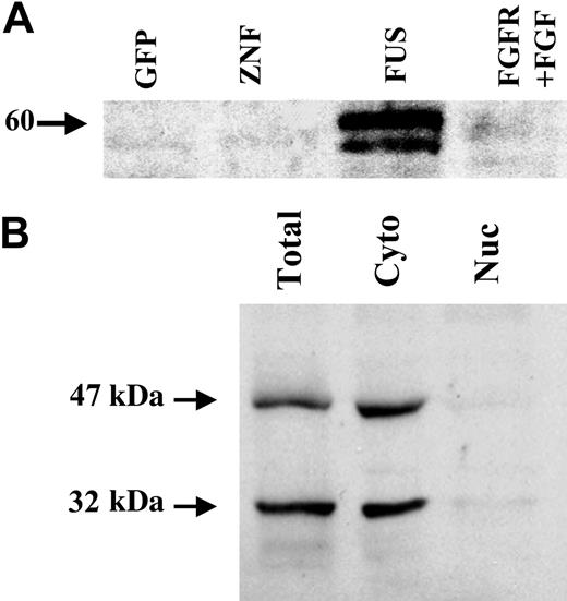 Figure 2. Localization of PAI-2 in HEK-293 cells expressing ZNF198/FGFR1. (A) Analysis of the secretion of PAI-2 into the supernatants from cells transfected with GFP, GFP-tagged ZNF198 (ZNF), GFP-tagged ZNF198/FGFR1 (FUS), or GFP-tagged FGFR1 (after stimulation with bFGF) demonstrates that only those cells expressing ZNF198/FGFR1 secrete PAI-2. (B) Cell lysates from cells expressing the fusion kinase show that the cytoplasmic fraction contains the 47-kDa and 32-kDa forms of PAI-2 but not the nuclear fraction.