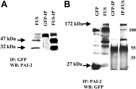 Figure 4. Interaction between PAI-2 and ZNF198/FGFR1. HEK-293 cells expressing ZNF198/FGFR1 (FUS) also express the 47-kDa and 32-kDa forms of PAI-2. Coimmunoprecipitation from ZNF198/FGFR1-expressing cells using the GFP antibody (A) identifies the 47-kDa and 32-kDa PAI-2 proteins which are not present in HEK-293 cells expressing GFP alone. The larger 55-kDa band in the IPs is derived from the IgG. (B) The HEK-293 cells expressing GFP (27 kDa) show a nonspecific band at 100 kDa but not the 172-kDa specific band corresponding to the ZNF198/FGFR1 protein (FUS). ZNF198/FGFR1-expressing HEK-293 cells show the fusion protein (172 kDa) and a series of degradation products we described previously.14 Co-IP with an anti-PAI-2 antibody reveals the 172-kDa ZNF198/FGFR1 protein in cells expressing this fusion kinase gene. Smaller bands in these IPs represent IgG heavy chain band and degradation products.