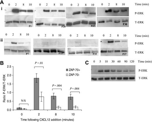 Figure 5. CXCL12 treatment results in prolonged activation of ERK in ZAP-70+ but not ZAP-70– CLL B cells. (A) Lysates were collected from CLL B cells treated for varying times with CXCL12 (100 ng/mL). Western blots were probed with an anti–phospho-p44/42 ERK (P-ERK) antibody (top panel) and then with an anti-p44/42 ERK (T-ERK) antibody to demonstrate loading (bottom panel). (i) ZAP-70+ PB CLL cells. (ii) ZAP-70– PB CLL cells. (B) Densitometric quantification of P-ERK and T-ERK Western blots from 7 ZAP-70+ and 7 ZAP-70– patients was carried out and the ratio of P-ERK to T-ERK was calculated to normalize for loading. Results are presented as mean ± SEM (Student 2-sample 2-tailed t test). (C) ERK activation following addition of CXCL12 in ZAP-70+ CLL B cells is sustained for up to 2 hours.