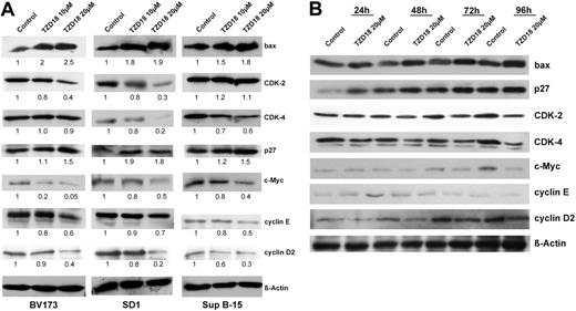 Figure 4. Expression of cell cycle- and apoptosis-related proteins in tested cell lines cultured with TZD18. (A) BV173, SD1, and Sup B-15 cells were incubated with or without TZD18 (10 or 20 μM, 4 days), and cell lysates were examined for cell cycle- and apoptosis-related proteins by Western blot, as described in the “Materials and methods.” A representative blot of 3 independent experiments is shown. The relative intensity of each band was quantified using Phoretix ID Quantifier software and was expressed as percentage of control. (B) Equal amounts of protein prepared from SD1 cells exposed to TZD18 (20 μM) for different durations were examined for the same cell cycle- and apoptosis-related proteins as in panel A.