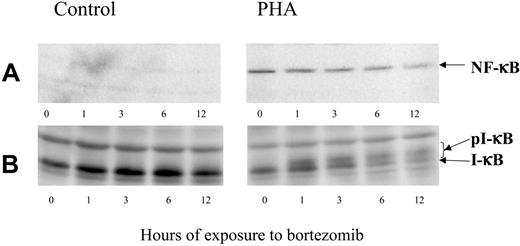 Figure 2. Western blot analysis of NF-κB and IκB expression in control or PHA-stimulated cells, exposed to 100 nM bortezomib for different time periods.