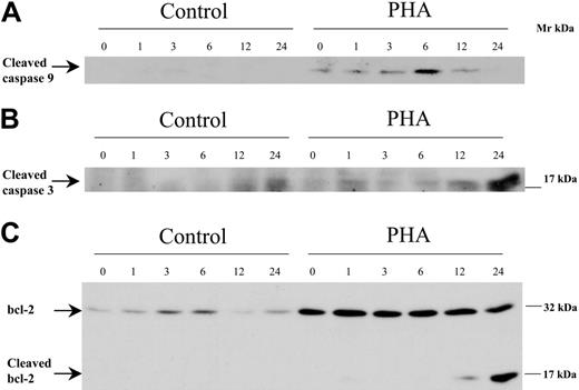 Figure 6. Western blot analysis of caspase-9, caspase-3, and bcl-2 in control or PHA-stimulated cells, exposed to 100 nM bortezomib for different time periods.