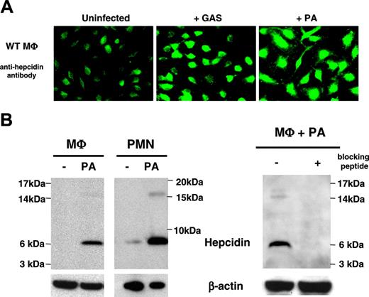 Figure 1. Hepcidin production is induced in neutrophils and macrophages by bacterial pathogens. (A) Immunofluorescence using anti-mouse hepcidin antibody on normal murine macrophages at baseline and upon exposure to Group A Streptococcus (GAS) or P aeruginosa (PA); magnification × 630. (B) Western blot analysis of hepcidin in murine macrophages and neutrophils at baseline and upon PA exposure. Addition of 10 μg blocking hepcidin peptide per milliliter of antibody was used to check for the specificity of the anti-mouse hepcidin antibody.