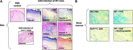 Figure 6. Myeloid cell hepcidin expression in a subcutaneous model of infection. (A) Immunohistochemistry using anti-mouse hepcidin and anti-polymorphonuclear leukocyte (PMN) antibodies on skin of WT and Tlr4Lps-d mice challenged with group A Streptococcus (GAS); controls include omission of primary antibody and addition of blocking peptide to the hepcidin antibody. (B) Immunohistochemistry using anti-mouse hepcidin antibodies on bone marrow of mice challenged with GAS; control corresponds to the addition of hepcidin blocking peptide to the hepcidin antibody. Magnification, × 400.