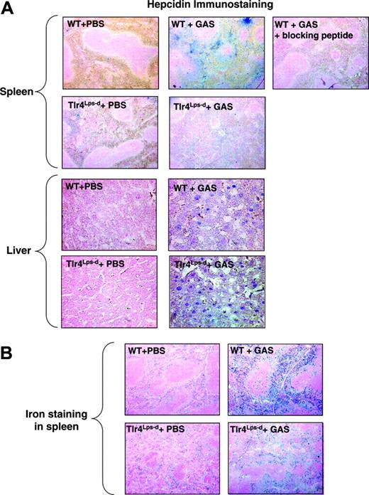 Figure 7. Hepcidin expression in liver and spleen of mice infected with GAS and iron staining. (A) Immunohistochemistry using anti-mouse hepcidin antibodies on livers and spleens of mice challenged with group A Streptococcus (GAS), magnification × 50 (spleen) and × 400 (liver). (B) Iron staining of splenic sections by Perl blue method following similar mouse challenge.