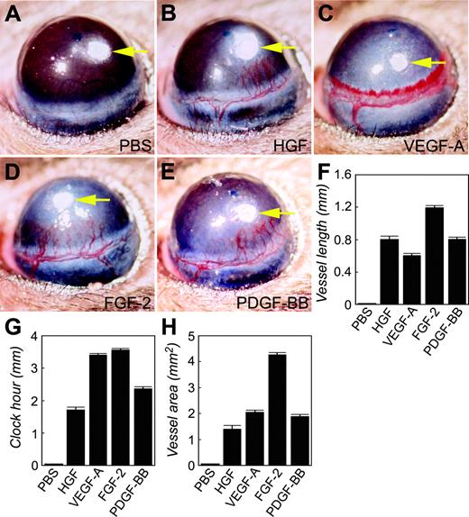 Figure 1. Stimulation of corneal angiogenesis. HGF (B), VEGF-A (C), FGF-2 (D), or PDGF-BB (E) was implanted into the micropocket of the mouse cornea. At day 5 after implantation, corneal neovascularization was photographed and measured as vessel length (F), clock hour (G), and vascularization area (H). Corneas implanted with phosphate-buffered saline were used as negative controls (A, F-H). Six to 10 corneas were used in each group. Error bars indicate SEM.