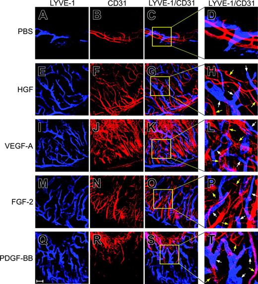 Figure 2. Stimulation of lymphangiogenesis. At day 14 after pellet implantation, corneal tissues were used for whole mount double staining with antibodies against Lyve-1 (A, E, I, M, and Q) and CD31 (B, F, J, N, and R). Lyve-1–positive signals are in blue color and CD31+ signals are in red color. Lyve-1–positive and CD31+ signals in the same areas did not show overlapping staining (C, D, G, H, K, L, O, P, S, and T). Panels D, H, L, P, and T represent enlargement of the boxed areas of panels C, G, K, O, and S, respectively. Bar = 100 μm. White arrows point to Lyve-1–positive structures and yellow arrows point to CD31+ structures. Images were captured with a Zeiss LSM 510 confocal laser-scanning microscope (Carl Zeiss, Jena, Germany) that includes an Axiovert 100M confocal microscope and a camera, and with Image Browser 5 LSM ver3.2 (Carl Zeiss). Images were taken with Plan Neofluar 10 ×/0.3 NA objective lenses. Figure panels were prepared with Adobe Photoshop 7.0 (Adobe Systems, San Jose, CA).