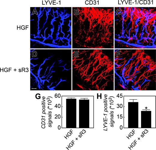 Figure 4. Inhibition of HGF-induced corneal lymphangiogenesis by a soluble VEGFR-3. HGF alone (A-C) or HGF/sVEGFR-3-Fc (D-F) implanted corneal tissues were double stained with a rat anti-CD31 antibody (red) and a rabbit anti–LYVE-1 antibody (blue) (A-F). Quantification of CD31+ (G) and LYVE-1–positive (H) signals (n = 7 different optical fields). *P < .05. Scale bar = 100 μm. Images were captured as described in Figure 2.