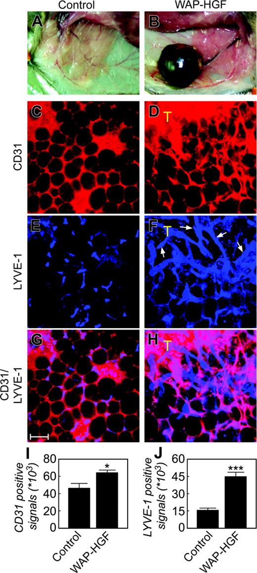 Figure 5. Whole mount staining of healthy mammary glands and mammary tumors. A healthy mammary gland of a WAP-HGF mouse served as a control (A), and a mammary tumor from a WAP-HGF transgenic mouse (B) was used for double staining with rat anti-CD31 (C-D, red) and rabbit anti–Lyve-1 (E-F, blue) antibodies. Panels G and H show CD31 and LYVE-1 double-positive signals of panels C and E, and D and F, respectively. T marks the tumor. Bar = 100 μm. Quantification analysis of CD31+ (I) and LYVE-1–positive (J) signals as μm2. *P < .05; ***P < .001. Error bars indicate SEM. Images in panels C-H were captured as described in Figure 2. Images in panels A-B were captured with a Nikon SMZ-2T microscope and a Nikon FDX-35 camera (Nikon, Tokyo, Japan) with a 15 × objective.