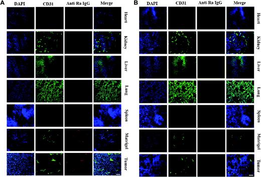 Figure 1. The distribution of cell-surface nucleolin in different tissues. (A) Purified antinucleolin Ab was injected intravenously into mice bearing S180 xenograft tumors or Matrigel plugs. Heart, kidney, liver, lung, spleen with tumors, and Matrigel plugs were removed 6 hours after injection for immunohistochemical assay. Cell-surface nucleolin was visualized by TRITC-secondary antibody against primary injected antibodies (red). The endothelial cells of blood vessels were stained with FITC–anti-CD31 (green), and nuclei were counterstained with DAPI (blue). Antinucleolin Ab specifically accumulated at angiogenic vessels of tumors or Matrigel plugs but did not appear in normal organs. (B) Nonspecific isotype Ab was injected as a control. Bar, 50 μm.
