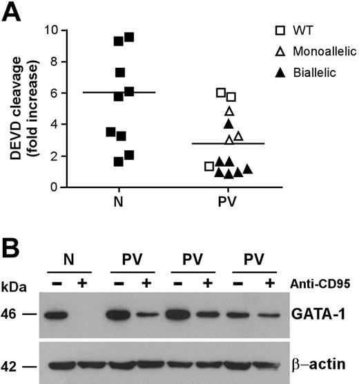 Figure 3. Caspase activation and GATA-1 cleavage in normal and PV erythroblasts. Erythroid precursors derived from CD34+ cells of healthy donors (N) and patients with PV (PV) characterized for the JAK2 V617F mutation (as in Figure 2) were cultivated in standard erythroid medium. At day 7 of culture, cells were stimulated with 250 ng/mL anti-CD95 antibodies for 24 hours in standard erythroid medium containing 0.5 U/mL EPO and were analyzed for caspase activation (P < .01) (A) and GATA-1 protein levels (B). Results shown in panel B were obtained with a pool of erythroblasts obtained from 3 healthy donors (N) and are representative of experiments performed with erythroblasts derived from 6 patients with PV harboring the JAK2 V617F mutation. Horizontal bars in panel A indicate the mean value of the N and PV caspase activation.