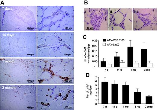 Figure 1. Mononuclear cells infiltrate the foci of VEGF-induced neovascularization. (A) Immunohistochemical time course analysis, by the visualization of small arteries using an antibody against smooth muscle actin (α-SMA), of the angiogenic response induced by AAV-mediated VEGF expression in normal skeletal muscle at different times after vector injection. Abundant mononuclear cell infiltrates are detectable in the perivascular spaces of the injected muscles (enlargements i-iii in panel B). Images were obtained using an Olympus CX40 microscope and 10 ×/0.30 NA and 40 × 0.75 UPlan FL objective lenses (Olympus, Tokyo, Japan). Images were captured using Olympus Camedia C-3030 digital camera and processed with Adobe Photoshop 7.0 software. (C) Quantification of the number of α-SMA–positive vessels over time. Shown are means and standard deviations of counts, expressed as number of α-SMA vessels per muscle fiber. The quantifications were carried out by 3 independent investigators who observed 10 different sections from 3 animals per time point. d indicates days; mo, months. (D) Quantification of the number of the infiltrating cells in the AAV-VEGF–treated muscles. Shown are means and standard deviations of counts, expressed as number of nuclei per muscle fiber. The quantifications were carried out by 3 independent investigators who observed 10 different sections from 3 animals per time point.