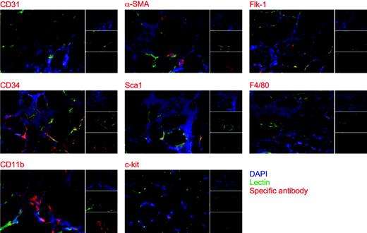 Figure 2. Immunologic characterization of the mononuclear cells infiltrating the foci of VEGF-induced neovascularization. Immunofluorescence staining was performed using CD31-, α-SMA–, Flk-1–, CD34-, Sca-1–, F4/80-, CD11b-, and c-Kit–specific antibodies on histologic sections of mouse tibialis anterior muscles perfused in vivo with FITC-lectin. The analysis was performed at 2 weeks after AAV-VEGF transduction. As shown in the 3 small subpanels, red indicates cells positive for the different antibodies; green, whole vasculature stained with FITC-lectin; and blue, nuclei stained with DAPI. The 3 stainings are merged in the large panels.