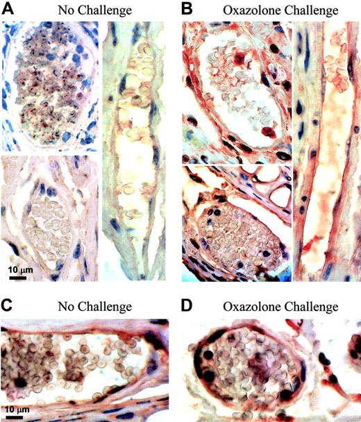 Figure 2. Heparanase expression in vivo upon DTH induction. (A, B) Endogenous heparanase: 5 days after sensitization, left ear (B) of female BALB/c mice (n = 4) was treated with oxazolone and the right ear (A) with vehicle alone. Ear tissues were harvested 24 hours after challenge and processed for immunohistochemical analysis of heparanase expression (reddish staining). Vascular structures were recognized as luminal or slit-like structures that occasionally contained blood cells and were delineated by flattened endothelial cells. This experiment was repeated 3 times, and a similar immunostaining pattern was obtained with 2 different antiheparanase antibodies. Representative microphotographs are shown. (A) Nonchallenged ear: capillary endothelial cells in the ear skin dermis are negative for heparanase staining (magnification × 1000). (B) Oxazolone-challenged ear: heparanase-expressing capillary endothelial cells are easily detected (× 1000). Control sections stained using secondary antibody alone showed no staining. (C, D) When DTH reaction was elicited in hpa-tg mice, positive staining was detected in capillary endothelium both prior to (C) and after (D) the challenge. Images were captured with a Zeiss Axioskop 50 microscope (Zeiss, Oberkochen, Germany) equipped with 100 ×/1.30 oil objective or 20 ×/0.50 objective lenses. Images were captured with a Kodak DC290 digital camera (Kodak, Rochester, NY).