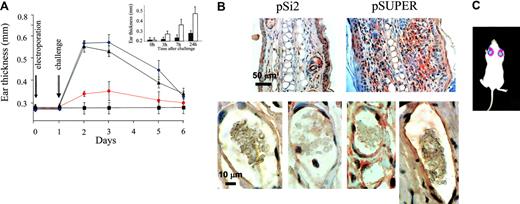 Figure 5. Effect of antiheparanase siRNA on DTH reactivity in vivo. Ears of oxazolone-sensitized BALB/c mice were electroporated with anti–mouse heparanase siRNA expression vector pSi2 (▪); empty vector pSUPER (▴); or received no plasmid or electroporation (♦), followed by challenge with the hapten 24 hours later. Hapten also was applied on the ears of 5 additional mice, which have not been previously sensitized or electroporated (▪). Three independent experiments were performed, and 5 mice per treatment were used. (A) Ear thickness was measured for 5 consecutive days after challenge. Inset. Effect of treatment with an inhibitor (ST1514) of heparanase enzymatic activity on DTH reactivity. ST1514 or vehicle alone was administered intraperitoneally prior to challenge and every hour thereafter (50 μg/injection) during the following 8 hours of the experiment. Filled bars: ear thickness in ST1514-treated mice; empty bars: ear thickness in vehicle-treated mice. (B) The ears in which DTH was induced following electroporation with pSi2 (left) or pSUPER (right) vectors were harvested 48 hours after challenge and processed for immunohistochemical analysis of heparanase expression (reddish staining; sebaceous glands are positively stained in all preparates, due to nonspecific absorption, as previously reported.32 Top: magnification × 200; bottom: × 1000. Positively stained capillary endothelium is noted in the dermis of pSUPER but not pSi2-electroporated ear skin. (C) To demonstrate that electroporation ensures the actual delivery of plasmid DNA and its uniform expression in the ear tissue, the ears of male BALB/c mice were electroporated with a CMV-LUC construct, encoding for luciferase gene under the constitutive CMV promoter. Expression of luciferase in the mouse ears in vivo was monitored as described in “Materials and methods.”32