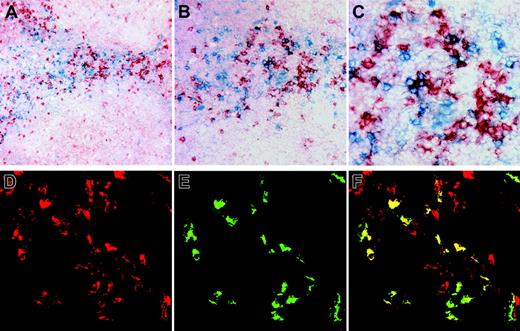 Figure 4. NK cells and pDCs colocalize in T-cell areas of normal human tonsils. (A-C) Double-staining of BDCA-2 (red) and CD56 (blue), showing CD56+ NK cells located in close association with BDCA-2+ pDCs in T-cell areas of human inflamed tonsils. Original magnifications, × 10 (A), × 20 (B), and × 40 (C). (D-F) Double-staining of BDCA-2 (red) and GITRL (green), showing a subpopulation of BDCA-2+ pDCs expressing GITRL. Original magnification, × 60 objective.