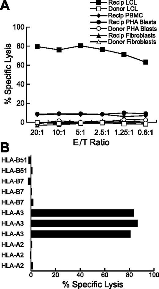 Figure 1. CTL Clone CTL-7A7 recognizes a HLA-A*0301-restricted mHAg that is selectively expressed in B-lymphoid cells. (A) The cytolytic activity of CTL-7A7 CTLs against EBV-LCLs, PHA-stimulated T-cell blasts, unfractionated peripheral blood mononuclear cells (PBMCs), and dermal fibroblasts derived from the transplant recipient (Recip) or donor was evaluated in a 4-hour 51Cr release assay at the indicated effector-target ratios. (B) Cytolytic activity at E/T 10:1 of CTL-7A7 CTLs against a panel of EBV-LCLs derived from unrelated individuals, each of whom shared 1 class I MHC allele with the recipient-donor pair from whom the CTL clone CTL-7A7 was derived. The specific class I MHC allele shared with the recipient/donor by each individual is indicated.