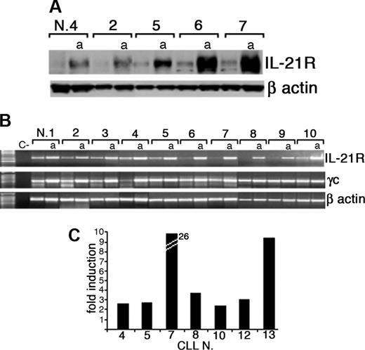 Figure 2. Expression of IL-21R protein and mRNA by CLL B cells is up-regulated by CD40 triggering. (A) Western blot analysis of total protein extracts from resting or CD40-activated (a) purified CLL B cells using an anti-IL-21R or an anti-β-actin antibody. (B) RT-PCR analysis of IL-21R and γc mRNA expression on freshly purified or CD40-activated (a) CLL B cells. A negative control (C-) without RNA was also included. Amplification of the same cDNAs with β-actin-specific primers is also shown. (C) Quantitative RT-PCR analysis indicates an increase of IL-21R mRNA in CD40L-activated CLL B cells with respect to resting cells. Data represent fold of increase and were normalized for the expression of RNA polymerase II mRNA as a housekeeping gene.