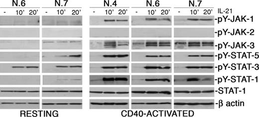 Figure 3. IL-21 induces tyrosine phosphorylation of JAK-1 and JAK-3 and of STAT-1, STAT-3, and STAT-5, but not of JAK-2 upon ligand binding. CLL B cells were stimulated with rhIL-21 (80 ng/mL) for the indicated time intervals, lysed in appropriate buffers, and analyzed by Western blotting using mAbs specific for phosphorylated or unphosphorylated forms of signal transducer proteins, or for β-actin.