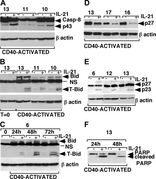 Figure 7. Western blot analysis of caspase-8, Bid, p27Kip-1, and PARP in IL-21-treated or untreated CLL B cells. (A) An increase of caspase-8 intermediate cleavage fragments (p43/p41) was detected in cell lysates of CD40-activated CLL B cells cultured with rhIL-21 (80 ng/mL) from 3 representative patients. (B) The truncated form of Bid (t-Bid) was observed in cell lysates of CD40-activated CLL B cells cultured in the presence of rhIL-21 (80 ng/mL) from 3 representative patients. (C) Bid expression is induced by 24-hour stimulation with CD40L-expressing cells and persisted for 72 hours, and treatment with IL-21 induces the appearance of t-Bid. (D) p27Kip-1 down-regulation was observed after rhIL-21 treatment (80 ng/mL for 72 hours) in lysates from CD40-activated CLL B cells of 3 different patients. (E) The use of a different Ab, recognizing a p27/Kip1 breakdown product, showed a cleavage product of 23 kDa of p27Kip-1 48 hours after IL-21 stimulation. (F) The cleaved form of PARP observed in CD40-activated CLL B cells after 24 hours of culture with IL-21, was further increased after 48 hours of culture in relationship with the increase of apoptotic cells.