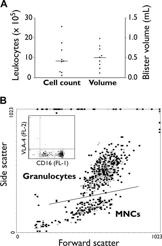 Figure 1. Leukocyte infiltration into cantharidin-induced skin blisters. Duplicate skin blisters were established by topical application of cantharidin (0.1%) to the forearm of 9 healthy individuals. Blister fluid was collected at 16 hours and analyzed: (A) for fluid volume and cellularity (each point represents the mean from 2 skin blisters; horizontal line represents the population median) and (B) by flow cytometry to distinguish leukocyte subpopulations. The representative dot plot in panel B shows gating into distinct granulocyte and mononuclear-cell populations by characteristic forward- and side-scatter properties. The inset shows CD16 and VLA-4 staining in the granulocyte gate, which allows neutrophils (CD16+VLA-4–) and eosinophils (CD16–VLA-4+) to be resolved and, furthermore, allows the proportion of apoptotic neutrophils (CD16dimVLA-4–) to be determined. CD14 staining in the FL-3 channel was used to resolve cells in the mononuclear-cell (MNC) gate into monocyte (CD14+) and lymphocyte (CD14–) populations.