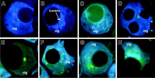 Figure 1. Different patterns of centrin staining. The isotypic PCs were identified by cytoplasmic κ or λ light-chain antibody conjugated with AMCA (cIg, blue), and centrin was stained with anticentrin2 conjugated with Alexa 488 (arrow; green). (A) Most PCs from healthy donors had no signals. (B-C) Cells with 1 to 4 signals were considered to have normal centrosome. (D-E) Centrosome amplification was seen in typical clonal PCs as well as the rare multinucleated PCs in patients. Various centrosome abnormalities were seen as follows: (D-E) increased number of signals in a cluster, (F) increased signals that were scattered, (G) coalescence of centrins into string-like structures, and (H) centrins staining up as ring-like structure. Abnormal centrosome structure as seen in panels F to H were predominantly seen in MM. The cells were visualized with a Leitz Epifluorescence microscope using a 100 ×/1.4 NA oil objective lens (Leitz, Wetzlar, Germany). The images were captured with the CoolSNAP ES CCD camera (Photometrics, Tucson, AZ) and acquired using either the Vysis smart capture software (Vysis, Downer's Grove, IL) or Oncor imaging system software (Oncor, Gaithersburg, MD). The acquired images were subsequently processed with Adobe Photoshop 7.0 (Adobe Systmes, San Jose, CA).