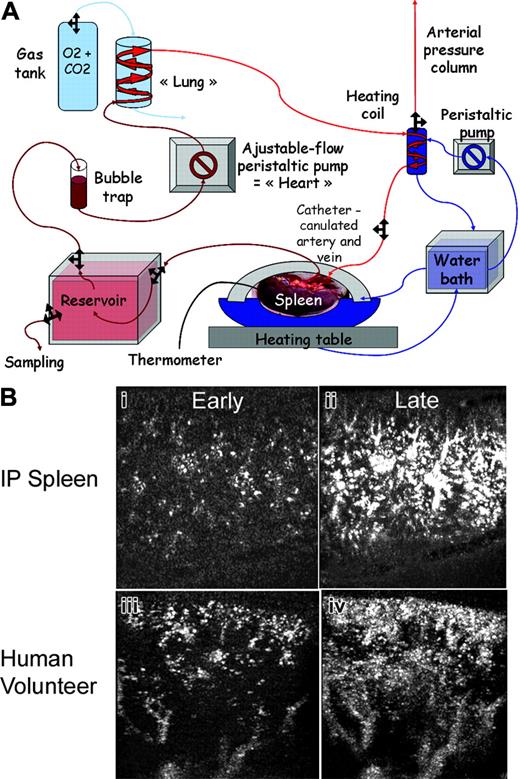 Figure 1. Description and vascular evaluation of the model. (A) Schematic diagram of the experimental set-up of the human IP-spleen. A peristaltic pump provides flow into polypropylene tubing. The perfusate is aspirated from the reservoir through a bubble-trap and then pushed into 2 m of silicone gas-permeable tubing around which a 3% CO2/100% O2 atmosphere is maintained through a constant 1 L/min gas flow. Prior to entry into the spleen through a glass catheter, the perfusate is warmed using a 37.5°C-equilibrated heating coil. Cells, reagents, and samples for analysis are introduced into or removed from the reservoir. (B) Qualitative comparison of patient and IP-spleen parenchymal enhancement using contrast ultrasonography. Early and late parenchymal aspect after bolus injection of contrast agent, from an IP-spleen (Bi-ii) and a representative human volunteer (Biii-iv) showing the same progressive homogenous enhancement. For technical reasons, the ultrasonographic section is from anterior capsule to posterior capsule in IP-spleens, whereas it is from capsule to hilum in patients.