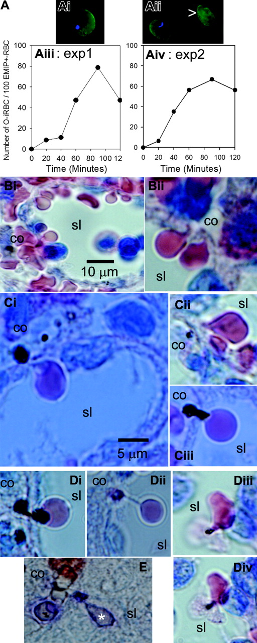 Figure 3. Kinetics and morphologic aspects of pitting. EMIF-positive iRBCs (EMIF+-iRBC) (Ai) were distinguished from once-infected RBCs (O-iRBC, Aii arrow) by the presence of intraerythrocytic Hoechst-labeled dead parasite remnants (DPRs). The proportion of O-iRBCs in the perfusate increased during experiments (Aiii-iv). On Giemsa-stained histologic sections, uninfected RBCs were observed as they squeezed to cross the sinus walls (Bi-ii) from cords (co) to sinus lumens (sl). During pitting of Art-iRBCs, small DPRs were left on the cordal side of the sinus wall—a typical aspect of the pitting process (Ci-iii)—whereas large DPRs had a bispherical cordal-luminal aspect (Di). Some DPRs retained in the sinus wall were still linked to their once-host cell by a string-like formation (Dii) and incompletely pitted Art-iRBCs were observed in sinus lumens, with a membrane-bound DPR in contact with a luminal cell (Diii-iv). (E) Aspect of pitting as observed by immunochemistry using a human convalescent serum, the Ig being detected by alkaline-phosphatase labeled reagent.