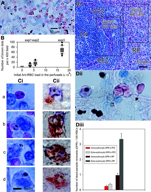 Figure 4. Art-iRBC retention and processing. (A-B) Aspect and quantification of brown dots on Giemsa-stained sections showing that they correspond to dead parasite remnants. Brown dots colocalized with red blood cells (intraerythrocytic dead parasite remnants; Dii, α) or not (extraerythrocytic dead parasite remnants). Extraerythrocytic dead parasite remnants could be further classified as extracellular (Dii, β), intracellular in cord cells (Dii, γ)or intracellular in sinus wall cells (Dii, δ). Most extraerythrocytic dead parasite remnants colocalized with cord cells (A,Dii). (B) Mean number of brown dots per × 400 field on Giemsa-stained section as box plots for 4 different spleens in which different parasite loads had been introduced. (Ci-ii) Aspect and localization of Art-iRBCs and extraerythrocytic dead parasite remnants at a cellular scale, analyzed either by Giemsa-staining (Ci) or by immunohistochemistry (Cii). Fragmented Art-iRBCs colocalized with cord cells/macrophages (Ci-ii, row c). (D) Microcirculatory structures of the spleen were identified on Giemsa-stained sections (Di) allowing differential counting of intraerythrocytic and extraerythrocytic dead parasite remnants (Dii) on × 400 fields. To adjust for circulatory space on each field, dead parasite remnants numbers are expressed as mean (and standard error of the mean) for 100 RBCs in each zone (Diii). For statistical analysis, see “Art-iRBC retention and processing are zone dependent.”