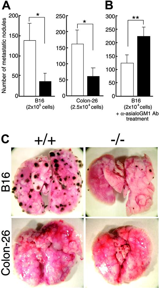 Figure 7. MIST deficiency protects mice from lung metastases. (A) B16 melanoma cells and Colon-26 carcinoma cells were injected intravenously into syngeneic wild-type (□) and MIST-deficient mice (▪) on the C57BL/6 and BALB/c background (4 mice per group), respectively, and metastatic nodules were counted 14 days later. (B) Number of metastatic nodules formed by B16 melanoma cells in the lungs of wild-type and MIST-deficient mice treated with anti-asialo GM1 antibody to deplete NK cells, as described in “Materials and methods.” Statistical analysis was performed using the Student t test (*P < .01; **P < .005). (C) Representative photographs of metastatic nodules in the lung are shown.