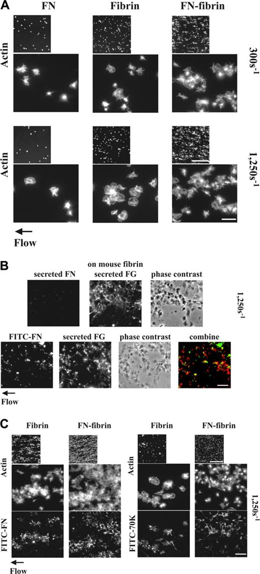 Figure 1. Adhesion and aggregation of platelets on fibrin and fibronectin-fibrin incorporation of soluble fibronectin or 70K fragment into platelet thrombi and effect of perfused fibronectin on the formation of platelet thrombi under shear conditions. (A) A suspension of platelets and red blood cells was perfused through a flow chamber opposed to a coverslip coated with fibrin or fibronectin-fibrin (FN-fibrin) at shear rates of 300 or 1250 s–1 for 5 minutes. Coverslips were taken out of the chamber and washed. Platelets were fixed, permeabilized, stained with rhodamine-phalloidin, and observed by epifluorescence microscopy. The small and large pictures were taken with × 10 (bar = 100 μm) and × 100 objectives (bar = 10 μm), respectively. (B-C) A suspension of platelets and red blood cells without soluble proteins (B) or premixed with 100 nM FITC-fibronectin or FITC-70K fragment (B-C) was perfused through a flow chamber opposed to a coverslip coated with human fibrin or fibronectin-fibrin, or mouse fibrin at a shear rate of 1250 s–1 for 5 minutes. (B) Platelets adhered to mouse fibrin-coated surfaces in the absence (top panel) or presence of FITC-fibronectin (bottom panel). Adherent platelets were fixed and incubated with a rabbit polyclonal antibody against human fibronectin and a mouse mAb against human fibrinogen, followed by incubation with FITC-conjugated anti–rabbit IgG and rhodamine-conjugated anti–mouse IgG antibody (top panel) or incubated only with mouse antifibrinogen antibody and rhodamine-conjugated antimouse IgG (bottom panel). The images in the lower panel were obtained by confocal microscopy and are from a 1-μm slice taken 4 μm above the plane of the coverslip. Bar = 10 μm. (C) Coverslips were taken out of the chamber after perfusion with FITC-fibronectin or FITC-70K fragment, and platelets were stained with rhodamine-phalloidin. Microscopy was performed as described. The small and large pictures were taken with × 10 (bar = 100 μm) and × 100 × (bar = 10 μm), respectively. The images of phalloidin-stained platelets should be compared with the bottom sections of panel A.
