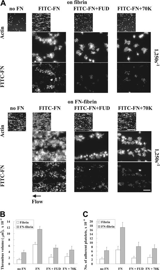 Figure 2. Effect of inhibition of deposition of perfused fibronectin on platelet thrombus formation under shear conditions. A suspension of platelets and red blood cells was premixed with 100 nM FITC-fibronectin (A) or unlabeled fibronectin (B-C) in the presence or absence of 1 μM FUD or 70K fragment and perfused through a flow chamber opposed to a coverslip or culture dish coated with fibrin or fibronectin-fibrin for 5 minutes at a shear rate of 1250 s–1. (A) Coverslips were taken out of the chamber, and microscopy was performed as described in Figure 1. The small and large pictures were taken with × 10 (bar = 100 μm) and × 100 objectives (bar = 10 μm), respectively. (B-C) Thrombus volumes and platelet numbers were measured as described in Table 1. Values represent the mean ± SD (n = 3 experiments).