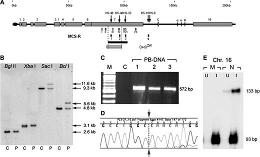 Figure 1. Summary of the molecular analysis of a novel interstitial upstream deletion. (A) The (αα)ZW deletion and its relative position within chromosome 16p13.3. Coordinates (in kb) according to GenBank no. NT_037 887.4 are depicted above the line. Erythroid DHS are shown as black arrows. Numbered gray boxes represent known genes9 located in this subtelomeric region in addition to the α globin genes (labeled with Greek symbols). The small gray bar below the line represents (αα)ZW deletion and the black bar represents the shortest region of overlap (20.4 kb) derived from previously characterized upstream deletions.5 The (αα)ZW deletion provides a new 3′ limit for minimal upstream sequences required for full α globin expression (14.7 kb, dashed line). The small white and gray boxes below the line represent probes used for Southern blotting (white) and MLPA (gray):10 (I) 757 × 758, (87 755-88 337); (II) 4a, (90 548-90 603); (III) 755 × 756, (96 671-97 389); (IV) 5a (103 695-103 774); (V) 767 × 768, (107 503-108 177); (VI) 769 × 770 (108 517-109 159); and (VII) 6a (120 541-120 590). Four small black boxes show the multispecies conserved sequences-regulatory elements (MCS-R1 to -R4). (B) Characterization of (αα)ZW breakpoint. The 3′ breakpoint of the (αα)ZW chromosome was characterized after BglII, XbaI, SacI, and BclI digestion, hybridized with combined probes V and VI. Breakpoint fragments were identified with SacI and BclI demonstrating that the 3′ breakpoint lies between coordinates 105 036-107 043. No breakpoint fragment was detected using probe III, showing that this region was deleted from the (αα)ZW chromosome. The 5′ breakpoint (coordinate 90 512-91 701) was identified using NcoI, PstI, HpaI, and HindII using probe I (not shown). C indicates control; P, patient. (C) Gap-polymerase chain reaction (PCR) amplified a 572-bp fragment specific to the (αα)ZW chromosome. Using forward (ZW-2F; 5′-GCTTAGGGGAAACTGCAGGTG-3′) and reverse (ZW-2R; 5′-AGGCAGACTGCACTTCATTGTTTA-3′) primers, the PCR product was amplified in peripheral blood DNA (PB-DNA) in triplicate. The PCR did not amplify a normal chromosome. M indicates 100-bp marker (New England Biolabs, Hitchin, United Kingdom). (D) Direct sequencing of the breakpoint fragment demonstrates the sequence adjoining between coordinates 90 777 and 106 774 (leftward and rightward to the arrow respectively). (E) Marked decrease in mRNA levels from the (αα)ZW chromosome. An RNase protection assay was used to analyze total RNA extracted from chromosome 16 x mouse erythroleukemia, interspecific hybrids. This showed a severely reduced level of human α globin expression (133-bp protected band) in both uninduced (U) and hemin-induced (I) cells containing the mutant (M) but not the normal (N) chromosome 16. The 93-bp protected fragment represents the mouse α globin mRNA as an internal control.