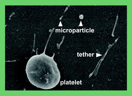 Scanning EM analysis of tethers and microparticles. See the complete figure in the article beginning on page 3537.