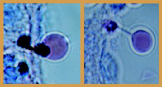 Pitting of dead parasite remnants from the infected red cells during passage from the splenic cord to sinus lumen. See the complete figure in the article beginning on page 3745.