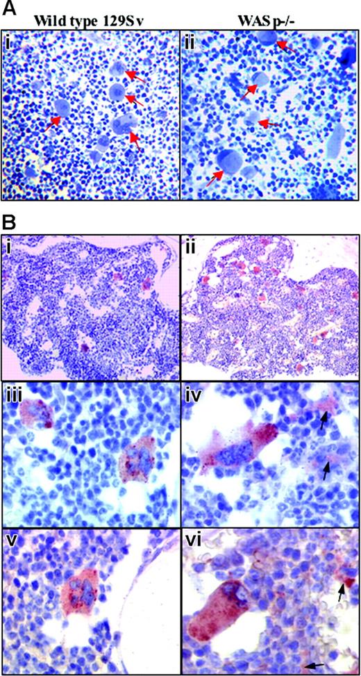Figure 1. In situ cytologic alterations of MKs in WASp-deficient bone marrow.(A) Semithin toluidine blue staining sections of wild-type and WASp-deficient bone marrows. Epon-embedded sections of wild-type bone marrow MKs examined by light microscopy show centrally located nuclei (i, arrows), whereas MKs in WASp-deficient bone marrow (ii, arrows) display eccentric moon crescent-like nucleus attesting for the cell structure disorganization (original magnification, × 200). (B) Immunohistochemical staining of VWF in wild-type (i,iii,v) and WASp-deficient (ii,iv,vi) bone marrows. Indirect immunolabeling of VWF by immunohistochemistry (described in “Materials and methods”) shows quantitative and qualitative alterations of WASp-deficient MKs and the abnormal presence of platelets in femoral bone marrow obtained from WASp-deficient mice in comparison with wild-type 129Sv mice. (i-ii) Normal distribution of MKs in mouse bone marrow is shown, whereas WASp-deficient bone marrow MKs appear more numerous (original magnification, × 200). (iii-iv) Typical morphology of MKs in wild-type bone marrow. Some WASp-deficient bone marrow MKs have lost their round shape, and they appear stretched with elongated cytoplasmic extensions resembling proplatelets (arrow) (original magnification, × 400). (v-vi) At a higher magnification, the MK appears well limited, with round shape. No labeling is detected in the extramegakaryocytic space. In contrast, WASp-deficient bone marrow MKs often exhibit an atypical shape with an eccentric position of the nucleus. Some labeling (arrow) is detected in the extramegakaryocytic space, suggesting the presence of in situ platelet production (original magnification, × 600).