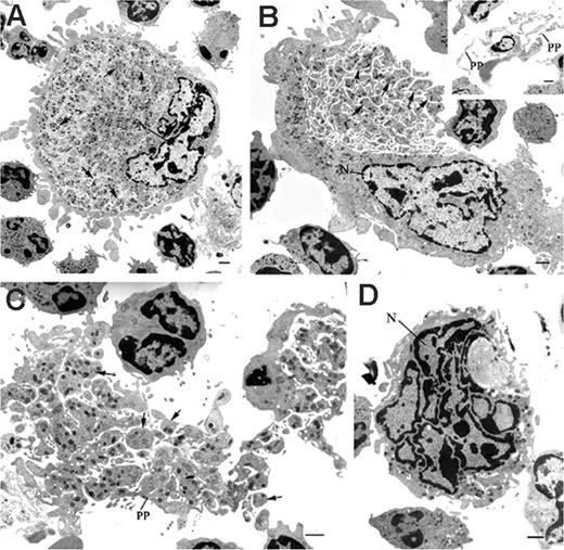 Figure 2. Representative electron-microscopic views of mature MKs in the bone marrow of WASp-deficient mice. Samples obtained from bone marrow of wild-type 129Sv and WASp-deficient mice were processed for electronic microscopy as described in “Materials and methods.” Ultrastructural analysis showed the abnormal presence of WASp-deficient MKs displaying morphologic features of maturing MKs. (A) Mature MK showing delineated platelet territories (arrows) (magnification, × 2200; bar, 1 μm). (B) Bone marrow MKs in the process of shedding platelets (arrows) (magnification, × 2200; bar, 1 μm). (Inset) Proplatelets (PP) extended from a mature MK within the bone marrow (magnification, × 1650; bar, 1 μm). (C) Platelets (P) and proplatelets (PP) released from MKs and scattered within the bone marrow (magnification, × 2950; bar, 1 μm). (D) Naked MK nucleus (N) found in the bone marrow space (magnification, × 3900; bar, 1 μm).
