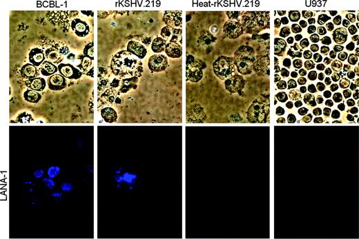 Figure 5. Viral gene expression in spleen and bone marrow cells recovered from NOD/SCID-hu mice reconstituted with rKSHV.219-infected CD34+ HPCs. Bone marrow cells recovered from rKSHV.219 mouse D6 were cultured ex vivo for 33 days in complete IMDM. Bone marrow cells were analyzed by IFA using a rat anti-LANA-1 primary antibody and an AMCA antirat secondary antibody. Bone marrow cells recovered from a NOD/SCID mouse inoculated with heat-inactivated rKSHV.219-infected HPCs also were analyzed. BCBL-1, a KSHV-positive primary effusion lymphoma cell line, was used as a positive control for LANA-1 IFA. U937, a myeloid leukemia cell line negative for KSHV infection, was used as a negative control. Cells were visualized under a 20 ×.0.45 Plan-Fluor extra-long working distance (ELWD) dark medium (DM) objective lens (Nikon, Tokyo, Japan); total magnification, ×/200.