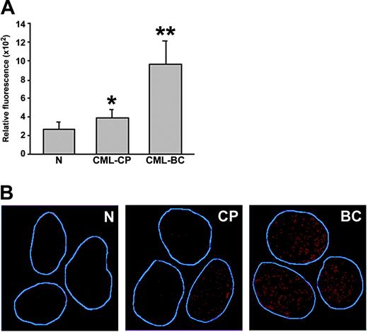 Figure 5. Primary CML cells contain elevated levels of ROS and oxidative DNA lesions. (A) ROS levels in mononuclear bone marrow cells from healthy volunteers (N), CML-CP, and CML-BC patients were analyzed by fluorescence; bars show mean ± SD; *P = .02, **P = .001 compared with N group. (B) 8-oxoG nuclear staining detected by immunofluorescence. The nuclei borders are marked in blue.