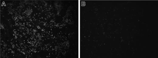 Figure 4. TLR4 is required for LPS binding to mouse platelets. C57BL/10ScSn (n = 9) and C57BL/10ScN (n = 8) mice were given intraperitoneal injections of O157LPS, and platelets were taken after 4 hours and fixed on glass slides, as described for human PRP. PRP from a C57BL/10ScSn wild-type mouse (A) incubated with anti-O157LPS antibody showed aggregates of platelets labeled with O157LPS. No labeling of the O157LPS antibody was detected on platelets from a C57BL/10ScN mouse (B).
