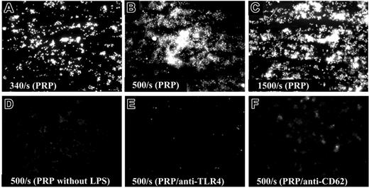 Figure 5. LPS-induced platelet activation. (A) HMEC-1 cells were grown on glass slides and incubated with O157LPS for 1 hour at 37°C. Before perfusion, cells were washed and serum-free medium was added. Platelets were fluorescently labeled with quinacrine dihydrochloride (10 μM). PRP perfused over HMEC-1 incubated with O157LPS at lower shear rates (340 s-1) showed multiple small aggregates of attached platelets. (B) Attachment increased at higher shear rates (500 s-1). (C) Larger aggregates formed at 1500 s-1. (D) PRP perfused over HMEC-1 cells that were not incubated with O157LPS. Preincubation of PRP with anti-human TLR4 (E) or anti-CD62 (F) inhibited binding between platelets and cell-bound LPS.