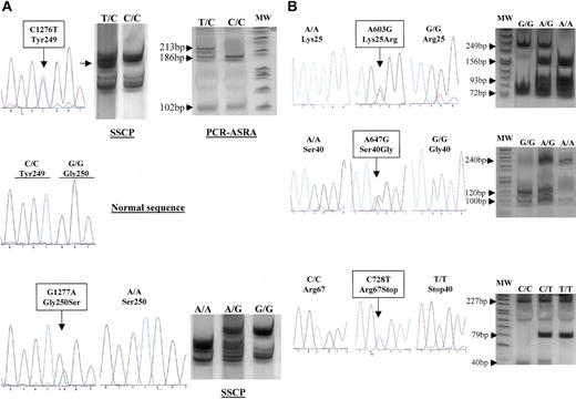 Figure 1. Identification of genetic variations in the ZPI encoding gene. (A) Variations in exon 3. (B) Variations in 5′-end of exon 2. MW indicates molecular weight marker (φX174 DNA/HinfI Marker; Promega, Madison, WI).