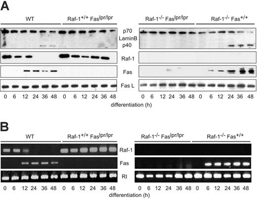 Figure 3. The lpr mutation abrogates lamin B cleavage and Raf-1 downregulation in differentiating erythroblasts. Lamin B cleavage and the expression of Raf-1, Fas, and FasL were determined by immunoblotting (A) or by RT-PCR (B). The experiments were repeated 4 times (A) or twice (B) with comparable results. In panel B, the ribonuclease inhibitor (RI) was amplified in parallel reaction as a reference gene.