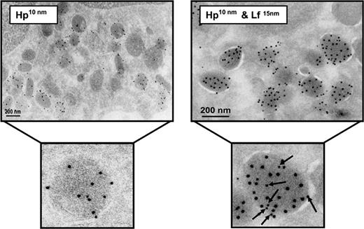 Figure 3. Hp and lactoferrin colocalize in specific granules of neutrophils. Cryosections of peripheral-blood neutrophils were labeled with rabbit anti-human Hp antibodies followed by a 10-nm protein A-gold probe (left). In addition, cryosections (right) were double-labeled, first with a rabbit anti-human Hp antibody and a 10-nm protein A-gold probe and subsequently with a rabbit anti-human Lf antibody and a 15-nm protein A-gold probe. Immunoelectron microscopy demonstrates the ultrastructural colocalization of Hp (arrows) and Lf in specific granules.